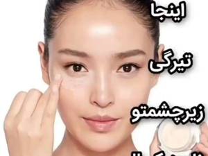 رفع تیرگی دور چشم در رشت