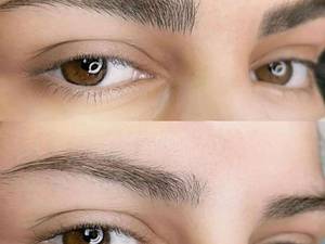 مرکز تخصصی میکروبلیدینگ  ابرو  در تهران