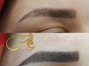 ارائه ی تکنیک هیبریدی در بوشهر