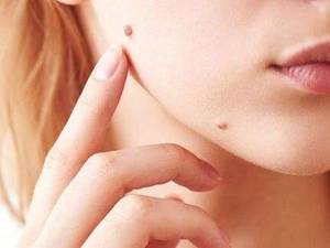 آموزش دوره های خال برداری