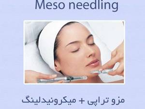 مزو تراپی + میکرونیدلینگ