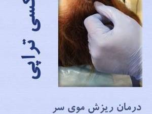 کربوکسی تراپی