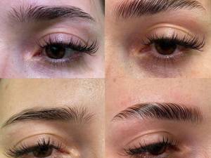 اجرای  حرفه ای لیفت ابرو در آستارا