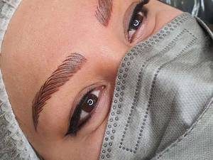 میکروبلیدینگ کار خوب در اهواز