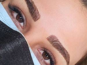 میکروبلیدینگ به روش بولدبروز در اهواز