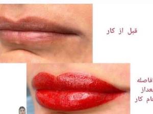میکرو کار حرفه ای در رشت