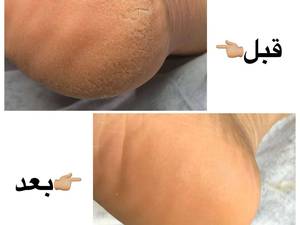 پدیکور پا در چالوس