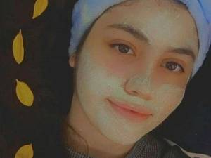 انجام پاکسازی پوست در انزلی