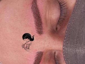 اجرای تکنیک فیبروز به صورت تخصصی در لرستان