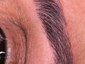 میکروبلیدینگ کار خوب در رشت