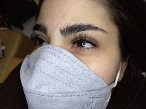 کاشت مژه کلاسیک عروسکی