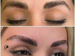 لیفت ابرو بصورت تخصصی و حرفه ای