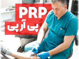 جوانسازی چهرا با انجام پی آر پی (PRP)