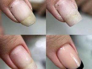 آموزش کاشت ناخن در پیروزی تهران