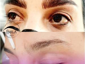 بن مژه و میکروبلیدینگ