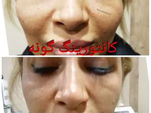 کات گونه در بوشهر