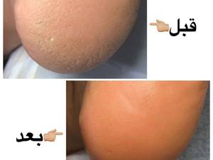 پدیکوریست حرفه ای