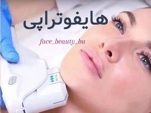 هایفوتراپی ولیفت صورت واز بین بردن غبغب