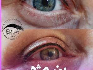 آموزش تخصصی بن مژه