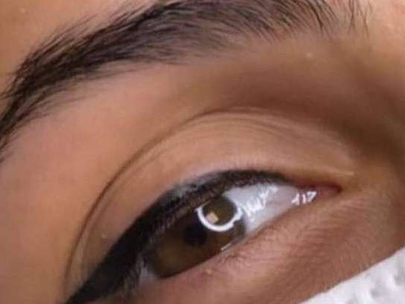تخفیف خدمات بن مژه