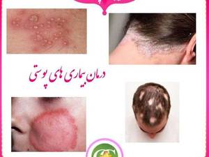 ویزیت پوست