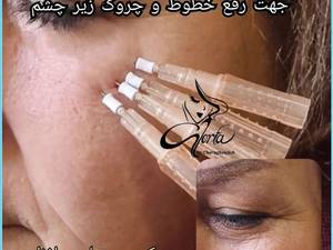 کاشت نخ اسکرو