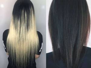 اکستنشن مو به روش میکرو لیزر