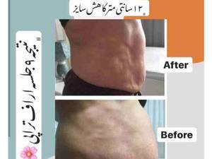 اراف تراپی کلینیک تغذیه و لاغری