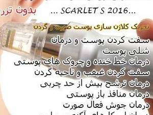 اسکارلت