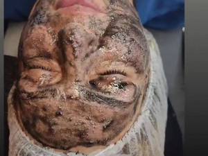 پاکسازی پوست