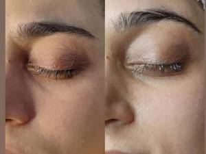 پاکسازی پوست