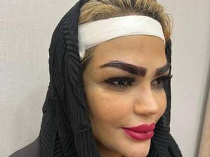 کاشت ابرو تخصصی