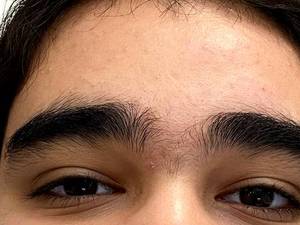 اصلاح تخصصی ابرو 