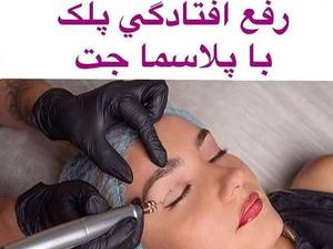 پلاسما پلکسر
